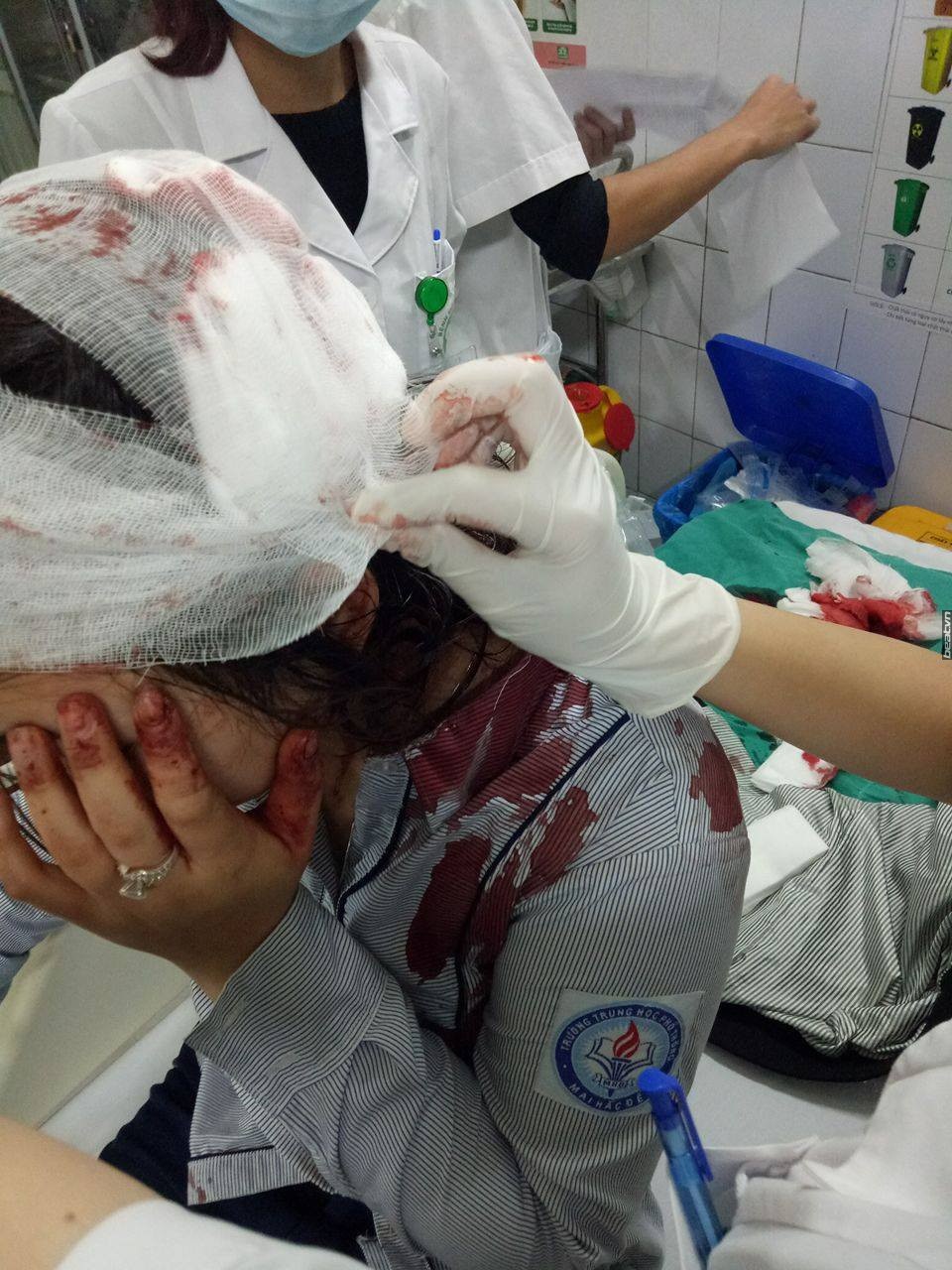 Hà Nội: Nữ sinh bị đánh gãy tay ngay tại cổng trường - 1
Nữ sinh K.C bị đa chấn thương phần mềm, gãy tay và phải khâu nhiều mũi ở đầu. (ảnh mạng xã hội)