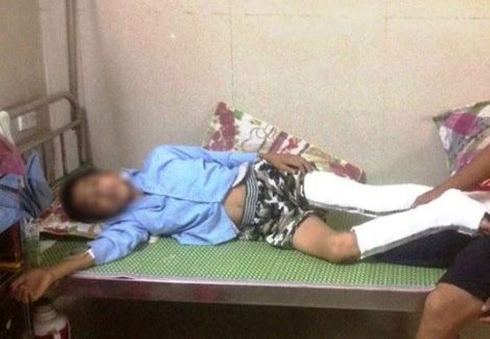 Học sinh nhảy lầu sau khi bị thu điện thoại: "Cô giáo làm đúng nên không thể xử lý" - 3 Em Q. bị gãy chân sau khi nhảy từ tầng 3 xuống đất, sau một tuần vẫn chưa khỏi để đi học trở lại được.