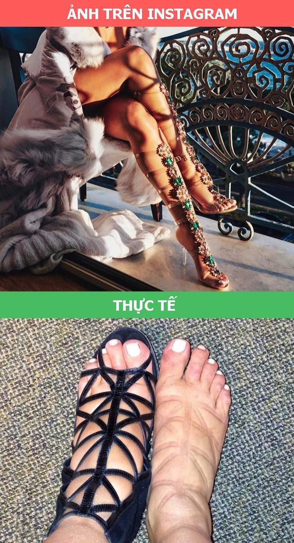 Bộ ảnh bóc mẽ những trào lưu đang “hot rần rần” trên Instagram - 1 Đằng sau đôi giày đan dây cầu kỳ gây bão trên Instagram chính là những vết hằn chằng chịt ở chân, mà chủ nhân của chúng phải lãnh đủ.