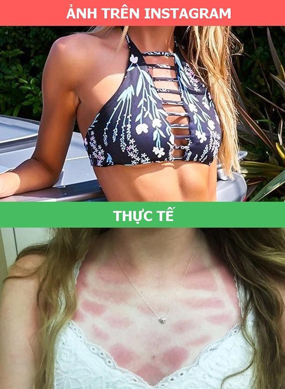 Bộ ảnh bóc mẽ những trào lưu đang “hot rần rần” trên Instagram - 4 Cái giá phải trả nếu muốn khoe bộ bikini phong cách tại bãi biển như các hot girl Instagram.