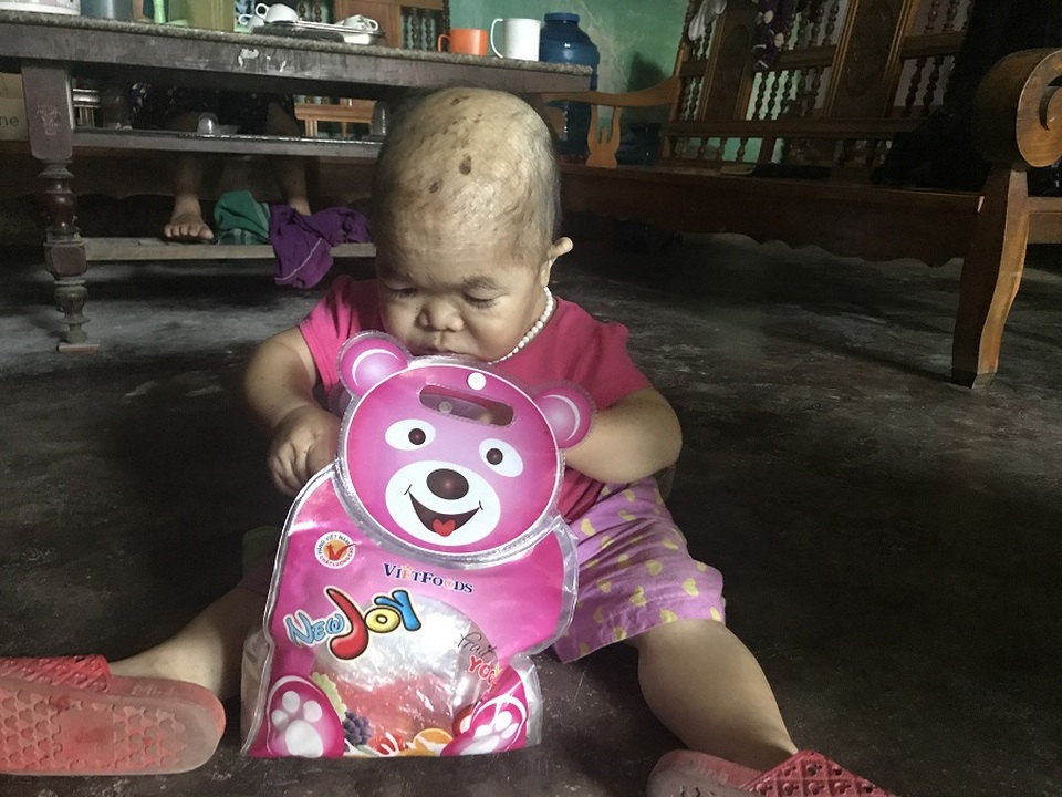 Kỳ lạ người phụ nữ 27 tuổi mang hình hài "trẻ lên 2" ở Thái Nguyên - 2 Theo bà Nguyễn, Dung cũng thích nũng nịu đòi đồ chơi mới, vui vẻ khi được mua quần áo đẹp. Ảnh: Minh Anh