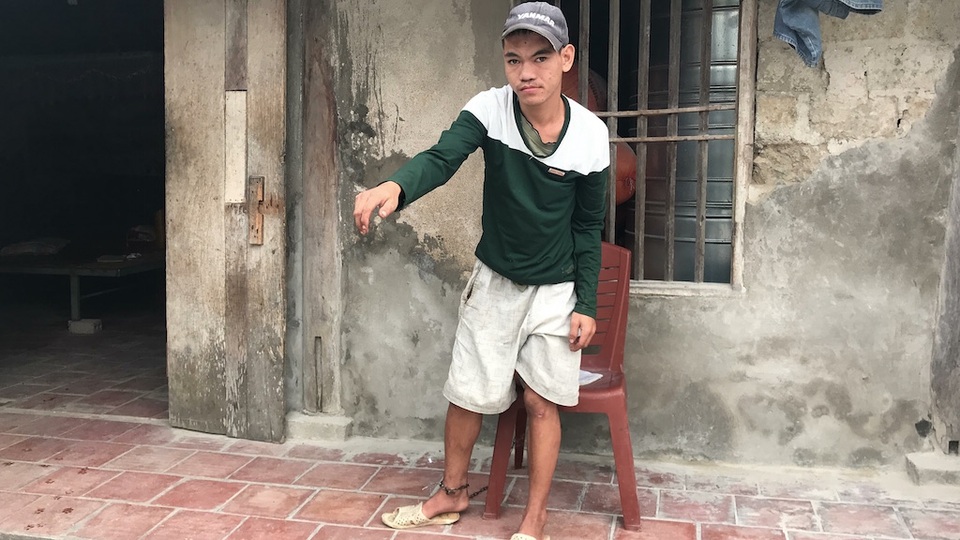 75 triệu đồng đến với hoàn cảnh người đàn ông cùng khổ nuôi 2 con trai bị tâm thần - 2 Do quá phá phách, nên đứa con thứ hai ông Huỳnh phải dùng xích không cho ra ngoài.