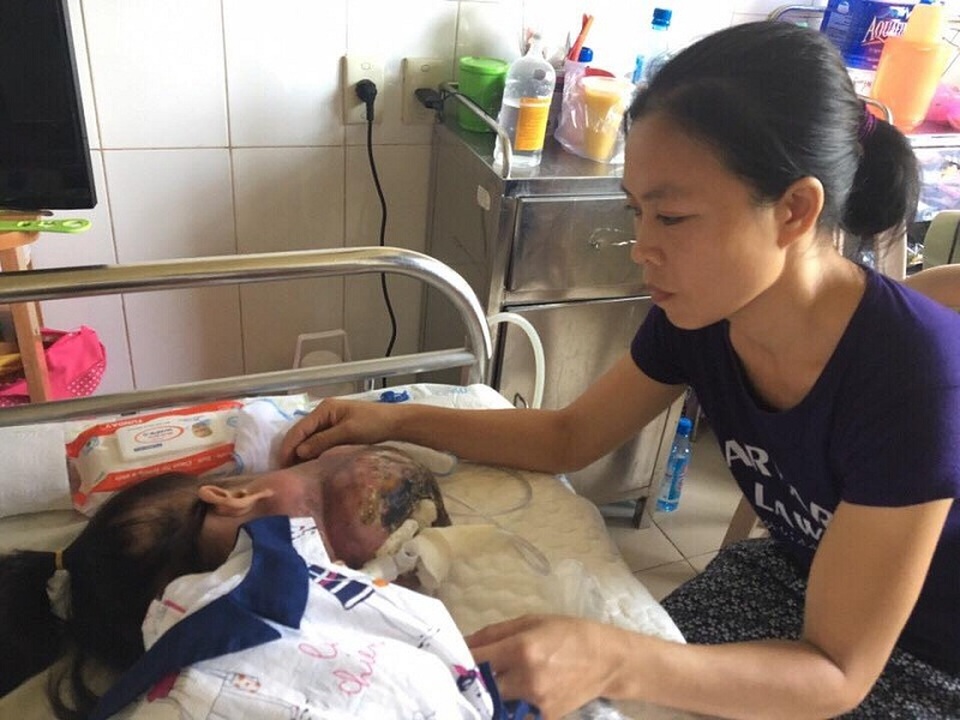 Hơn 50 triệu đồng đến với cô bé ung thư nằm đợi... “tử thần”! - 3 Kim Ngân đang được các bác sỹ tại Bệnh viện Trung ương Huế tiếp tục theo dõi, điều trị