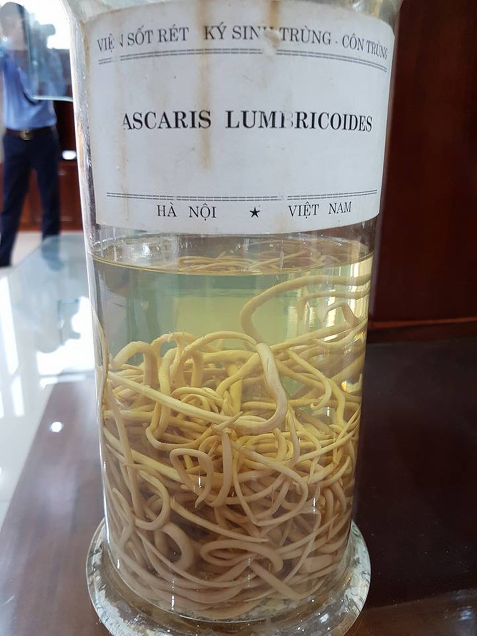 Giật mình hình ảnh ký sinh trùng “đục gan”, bó giun gây tắc ruột - 4 Giật mình hình ảnh ký sinh trùng “đục gan”, bó giun gây tắc ruột - 4