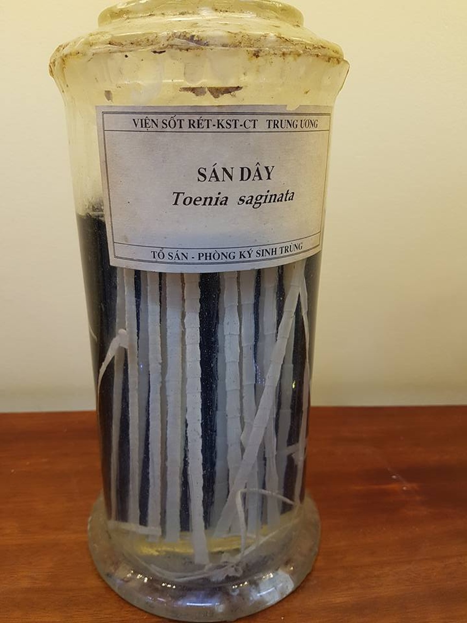 Giật mình hình ảnh ký sinh trùng “đục gan”, bó giun gây tắc ruột - 2 Những con sán dây như những dải lụa dài kí sinh trong cơ thể người bệnh được lấy ra.
