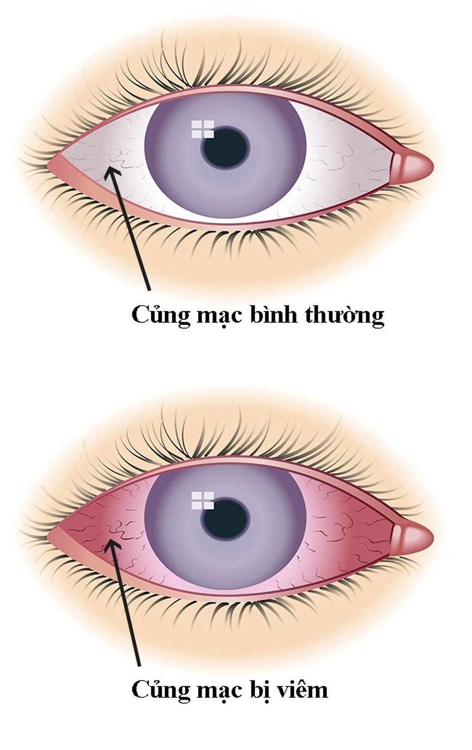 Những tác hại khi dùng không đúng cách 5 đồ vật này hằng ngày - 3 Những tác hại khi dùng không đúng cách 5 đồ vật này hằng ngày - 3