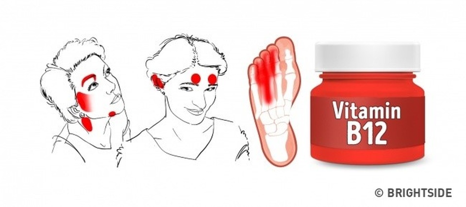 Những dấu hiệu cho thấy cơ thể thiếu vitamin - 6