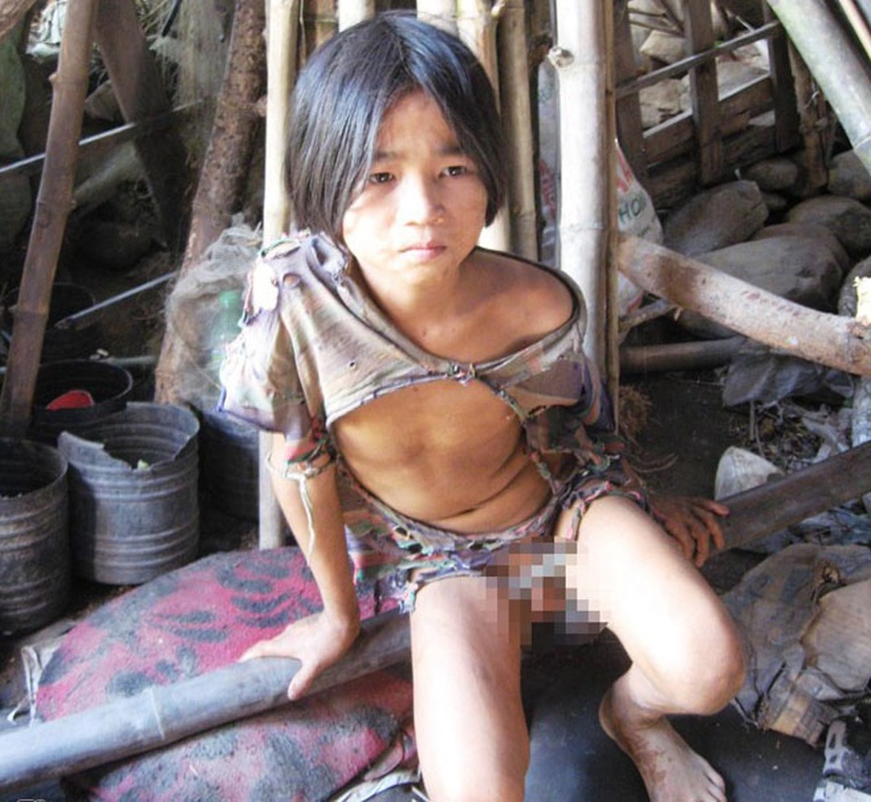 Những “người rừng” Việt Nam hàng chục năm sống tách biệt thế giới loài người - 3 Cậu bé người rừng chỉ mặc độc một chiếc áo suốt 5 năm trời.