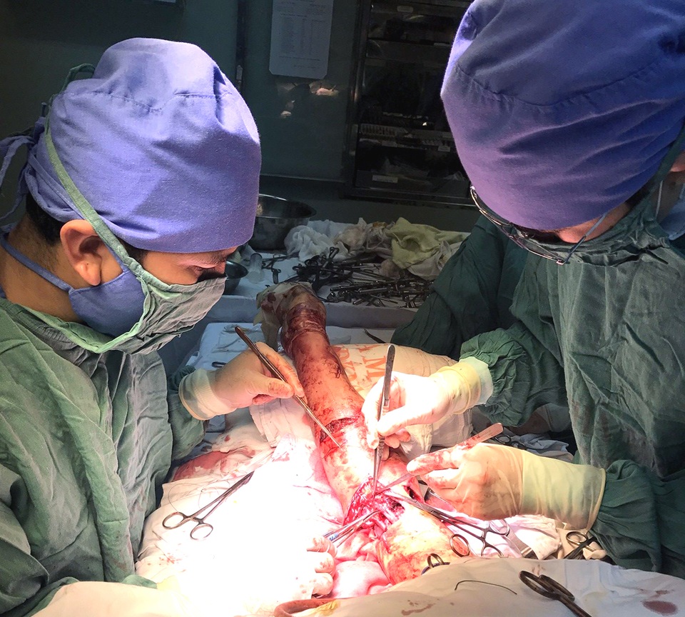 Nối thành công cánh tay thầy giáo bị tai nạn đứt gần hết - 2 Các bác sĩ BVHNĐK Nghệ An phải mất hơn 3h đồng hồ phẫu thuật nối lại cánh tay thầy giáo đứt gần lìa.