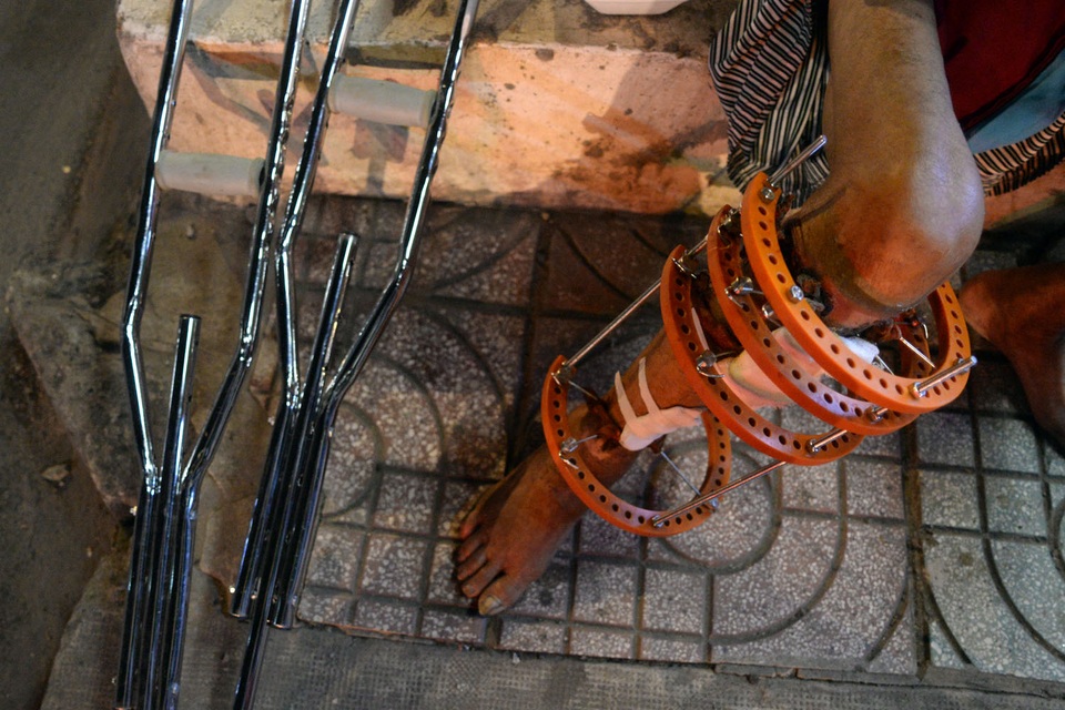 Những hình ảnh nhói lòng trong đêm Giao thừa - 7 Đi đứng khó khăn, nhưng ông Tiều vẫn cố gắng chống nạng đi lượm ve chai bán kiếm tiền, ăn uống bằng cơm từ thiện ở các chùa.