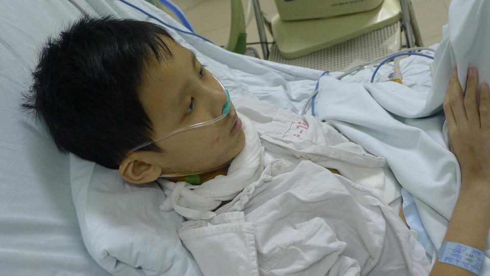 Cháu bé Nguyễn Thành Đạt ghép tim đã cai được máy thở - 2 Chức năng tim của em tốt, tuy nhiên hiện tại em đang bị phù phổi.