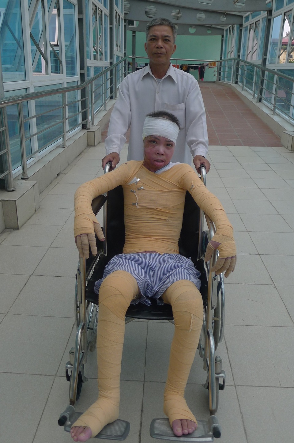 Chàng trai bị bỏng do nổ bình ắc quy xe đạp đã được xuất viện - 7 Nhờ tấm lòng của bạn đọc Dân trí, Đông đã được cứu sống và trở về nhà trong niềm vui đoàn tụ.