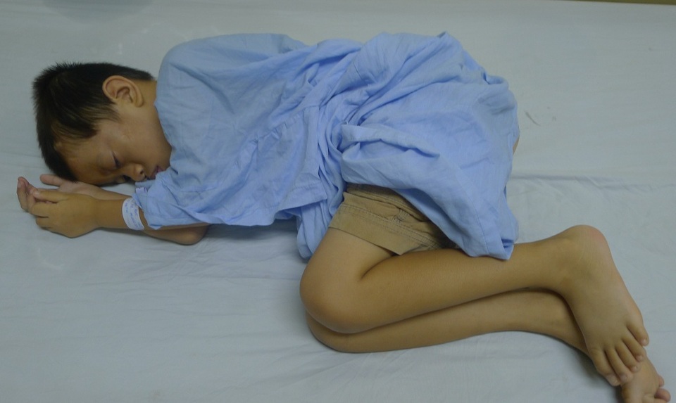 Bé 8 tuổi nguy kịch tính mạng vì phình động mạch cảnh khổng lồ - 2 Cậu bé gần như không còn sức lực, nằm co quắp trên giường bệnh.