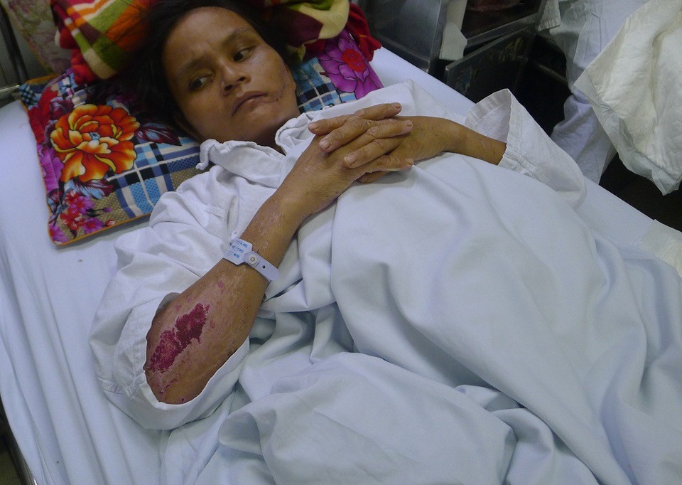 Quỹ Nhân ái hỗ trợ nóng 10 triệu đồng đến chị Hà Thị Phiếu - 1 Bị lũ cuốn đi, chị Phiếu được đưa đến viện cấp cứu trong tình trạng đa chấn thương.