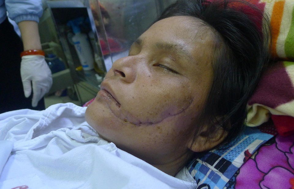 Chồng chết, vợ nguy kịch vì lũ cuốn trôi - 2 Hiện chị Phiếu chưa hay biết chồng không còn.