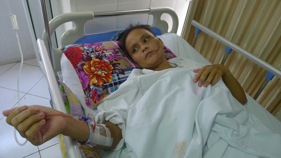 Quỹ Nhân ái hỗ trợ nóng 10 triệu đồng đến chị Hà Thị Phiếu - 2 Bản thân chị Phiếu đang rất cần sư giúp đỡ của cộng đồng để có điều kiện tiếp tục chữa bệnh.