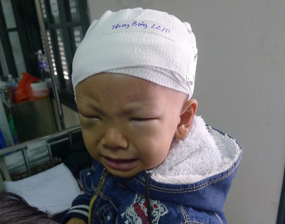 Đau đớn cảnh mẹ ung thư hạch, con ung thư võng mạc - 7 Cầu mong có nhiều tấm lòng đến với em để cậu bé đáng thương này tiếp tục được sống.
