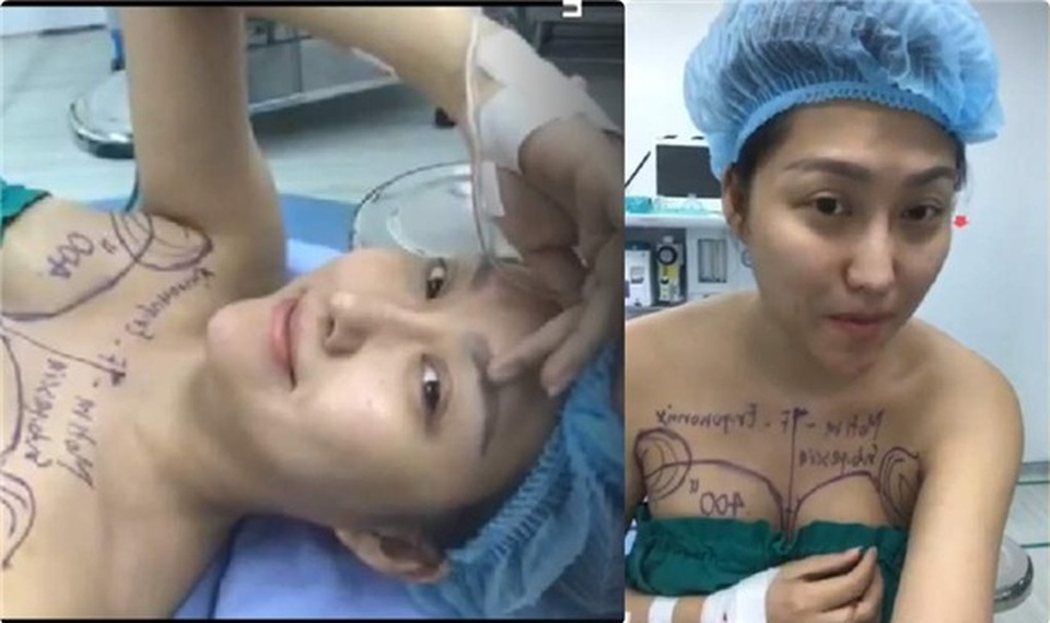 Tuyên bố “giải nghệ” hay chiêu trò gây chú ý của sao Việt? - 3 Cô nàng lắm chiêu trò công khai về cuộc đại phẫu thuật mới của mình.