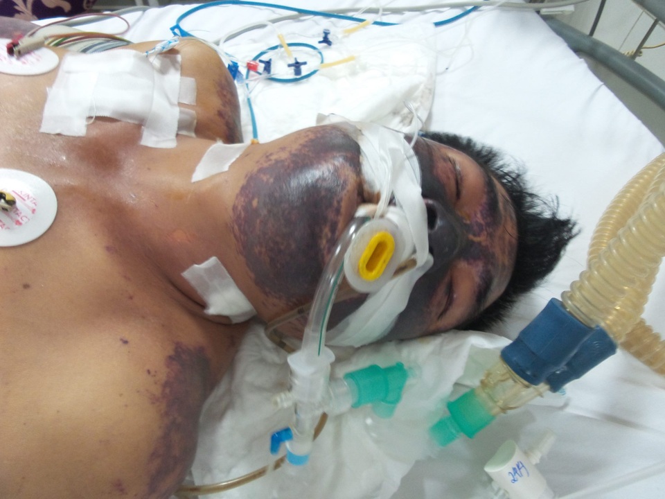 Dễ mắc bệnh chết người dịp Tết vì những hiểu lầm này - 1