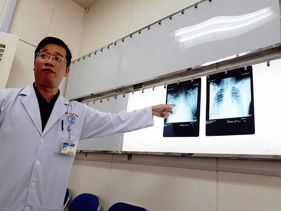 Thực hư vi rút lạ tấn công đạo diễn VTV - 1 Phổi của bệnh nhân V. đã ổn định hơn sau hai ngày điều trị tại khoa ICU BV Chợ Rẫy. Ảnh: HÀ PHƯỢNG
