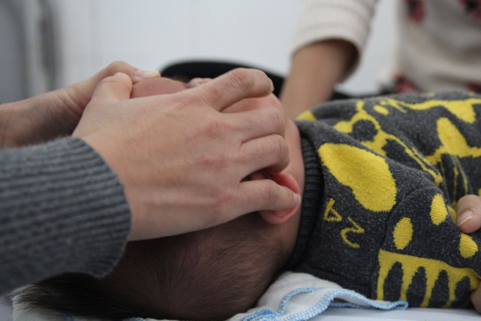 Rét đậm, nhiều người hoảng hốt méo miệng khi vừa tỉnh giấc - 1
Một em bé có biểu hiệu liệt cơ mặt được gia đình đưa tới BV Châm cứu Trung ương. Ảnh: P.P