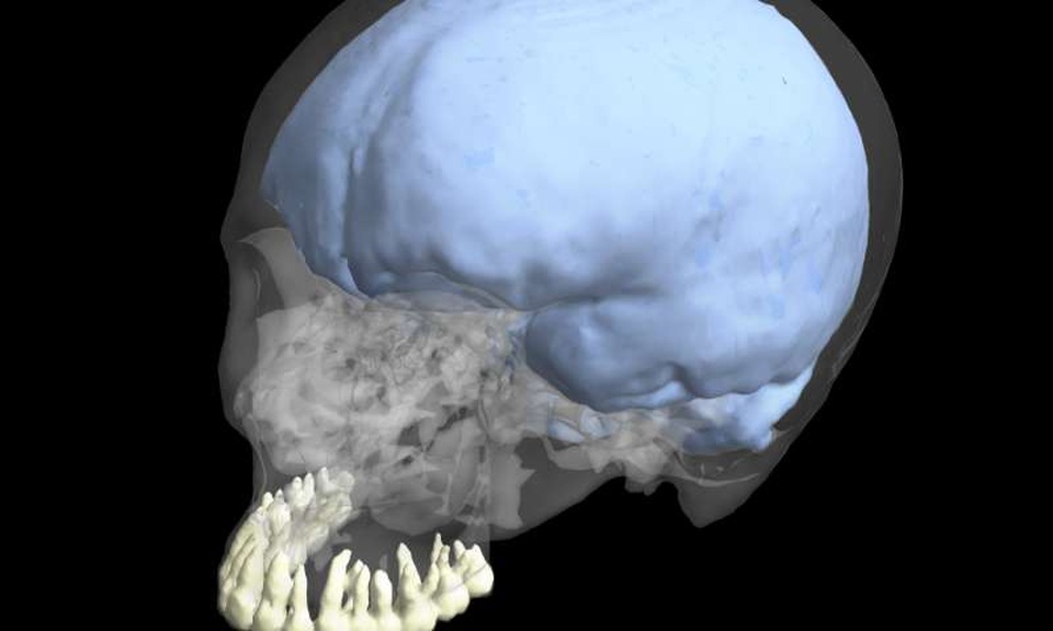 Sự tiến hóa của não bộ không có sự liên hệ tới kích thước răng ở người - 1