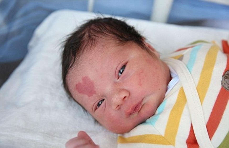 Mới sinh, Cinar đã có vết bớt hình trái tim trên trán