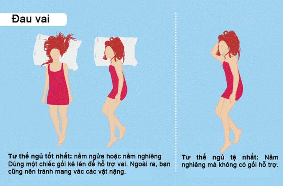 Tư thế ngủ tốt nhất và tệ nhất bạn cần biết - 2