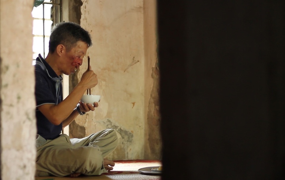 Căn bệnh quái ác khiến ông Sứ trở nên cô độc, sống khép kín suốt hơn 10 năm trời