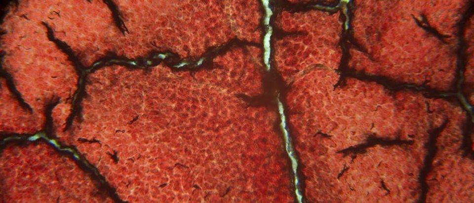 Tránh xa gừng nếu bạn có các dấu hiệu sức khỏe sau - 1