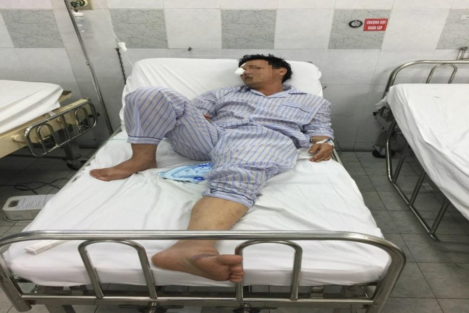 Vụ rò rỉ khí amoniac giữa khu dân cư, 3 người bị bỏng - 2 Tài xế H. đang điều trị mắt tại bệnh viẹn.