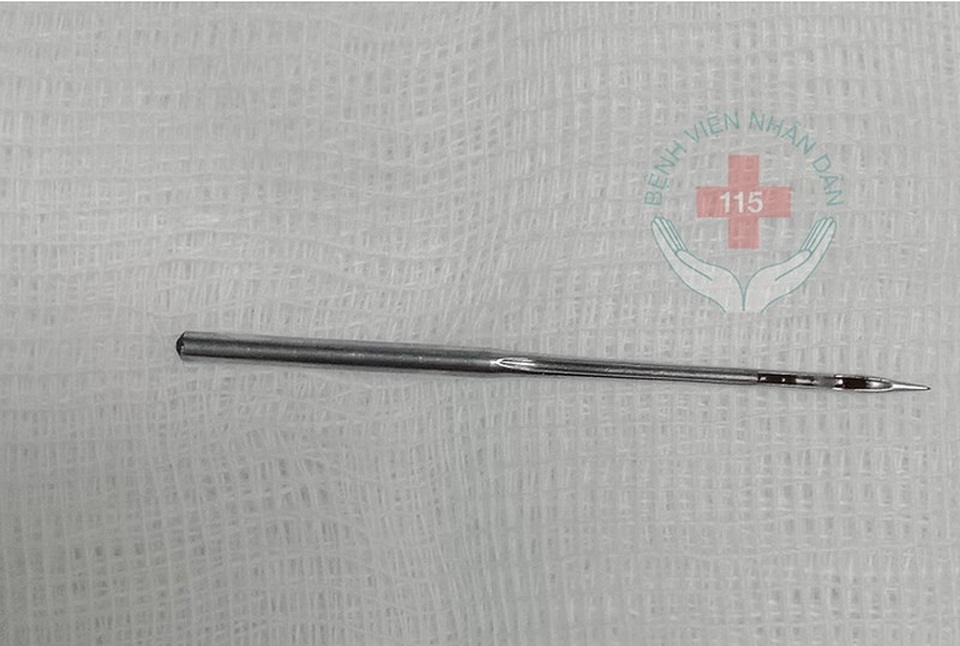 'Biểu diễn' không thành, kim may chui tọt vô bụng - 2 Kim may dài 2,5 cm, đầu nhọn. Ảnh: BV 115
