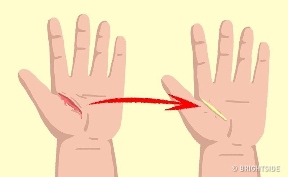 8 mẹo sinh tồn ai cũng nên biết để cứu mình cứu người khi hiểm nguy - 5 8 mẹo sinh tồn ai cũng nên biết để cứu mình cứu người khi hiểm nguy - 5