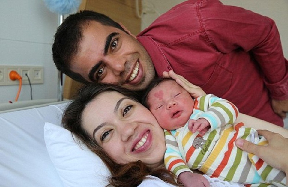 Gia đình Cinar tin rằng vêt bớt là dấu hiệu của may mắn