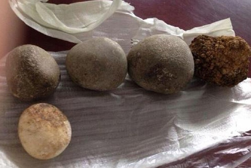 Sỏi mật trâu bò đắt như vàng ròng: 300 triệu/kg cũng khó mua - 3
Nhiều viên sỏi mật có trọng lượng nặng được bán với giá hàng trăm triệu đồng