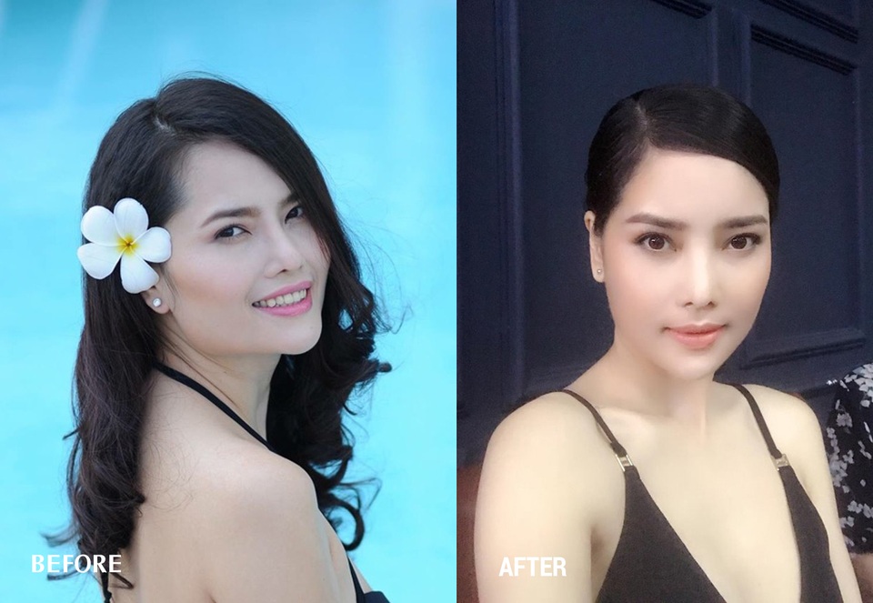 Á hậu Thùy Giang xinh đẹp và hạnh phúc nhờ thay đổi diện mạo! - 3 Diện mạo “Cải lão hoàn đồng” của Á hậu Thùy Giang sau phẫu thuật thẩm mỹ.