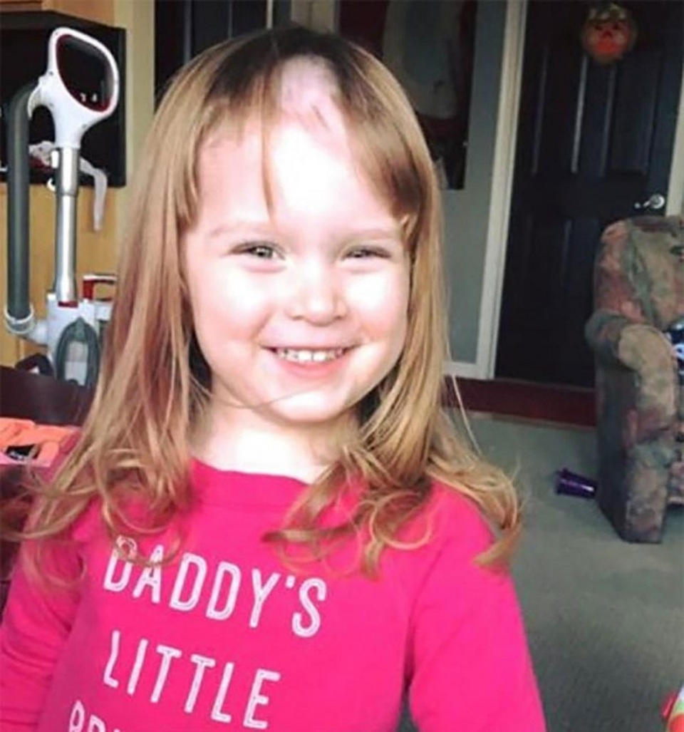 
Mất cả mảng tóc nhưng mà cô bé vẫn tự tin với khuôn mặt xinh và nụ cười tươi.
