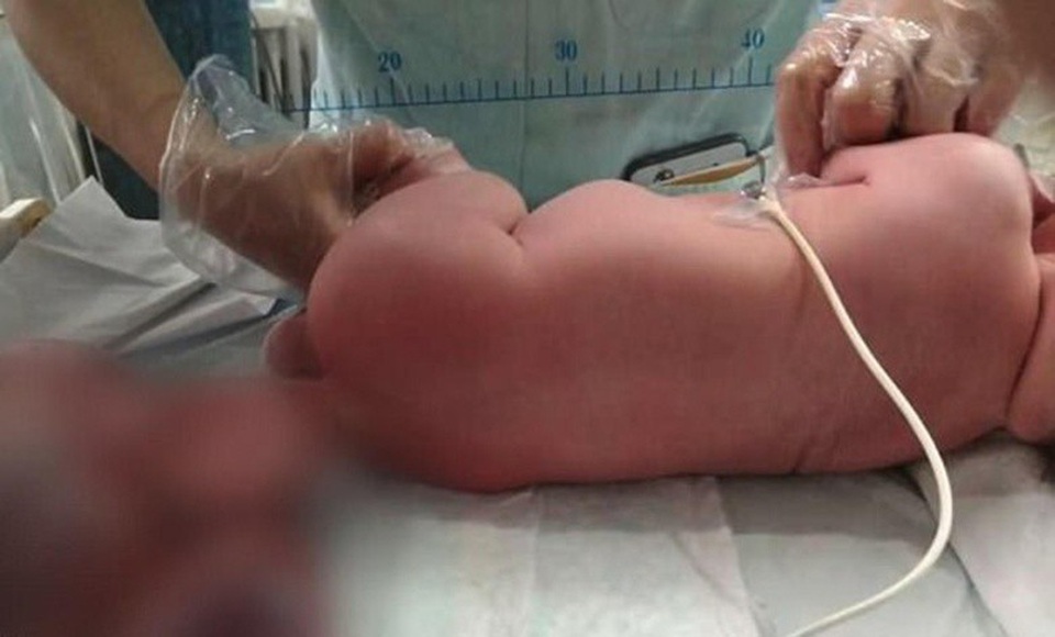 May mắn là Akram đang dần hồi phục sau ca mổ