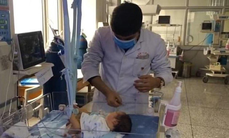 Đây là trường hợp bào thai ký sinh thứ ba tại bệnh viện nhi Urumqi trong năm nay