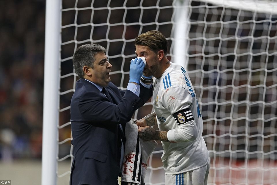 Phung phí nhiều cơ hội, Atletico và Real Madrid bất phân thắng bại - 2
Sergio Ramos đổ máu sau tình huống va chạm