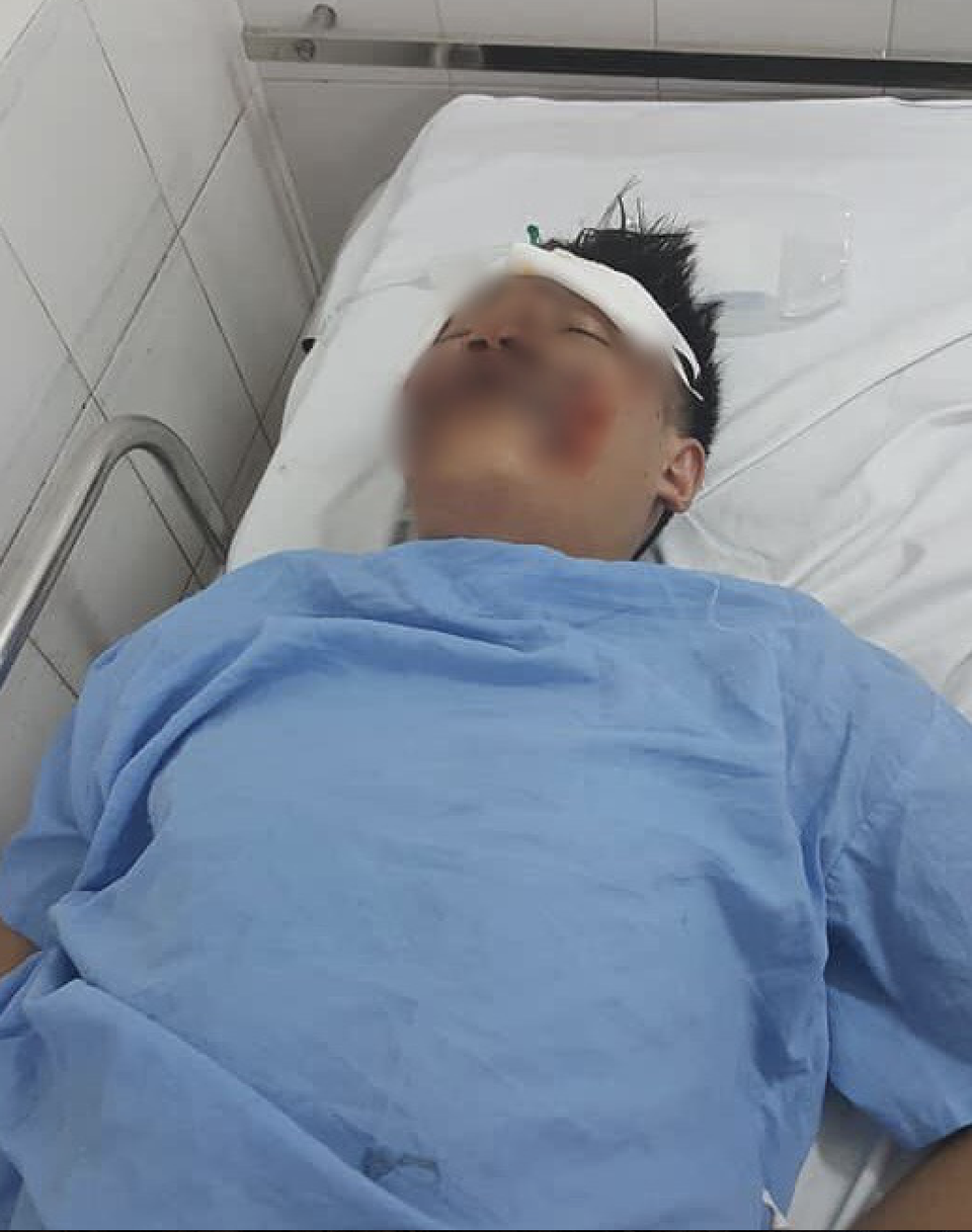 Hà Nội: Tài xế tông 2 sinh viên nguy kịch rồi lái xe bỏ trốn - 2
Một trong hai em nạn nhân bị chiếc ô tô tông, đang phải nhập viện cấp cứu.