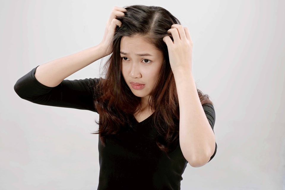 Vì sao không thể "dứt điểm" gàu dù đã thử rất nhiều cách? - 2 Vì sao không thể "dứt điểm" gàu dù đã thử rất nhiều cách? - 2