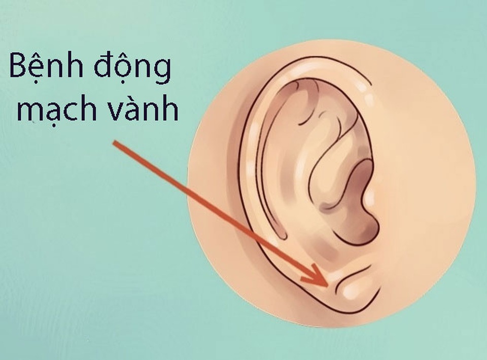 Tai bạn tiết lộ điều gì? - 3 Tai bạn tiết lộ điều gì? - 3
