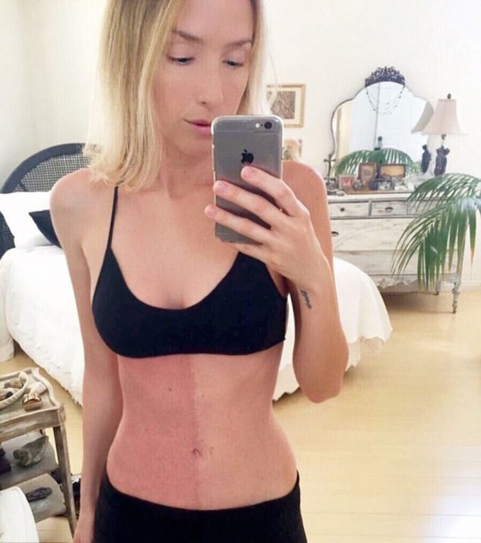 Kỳ lạ người phụ nữ có hai màu da, hai hệ miễn dịch khác nhau - 2 Kỳ lạ người phụ nữ có hai màu da, hai hệ miễn dịch khác nhau - 2