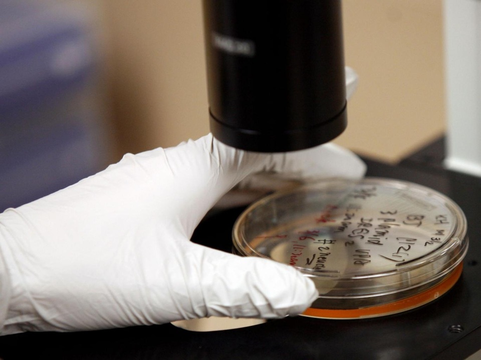 
Phẫu thuật tuyến tiền liệt là nguyên nhân gây ra 13% số ca rối loạn cương
