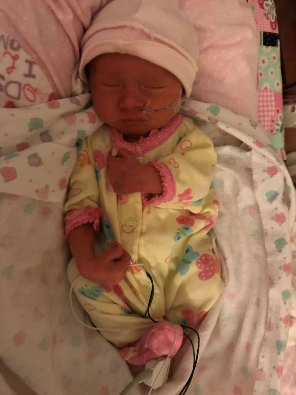 Ruby khi chào đời