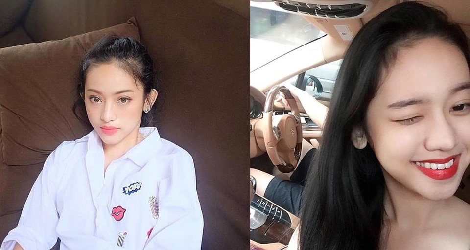 Nhan sắc nhờ dao kéo của cô gái trẻ lắm scandal - 2