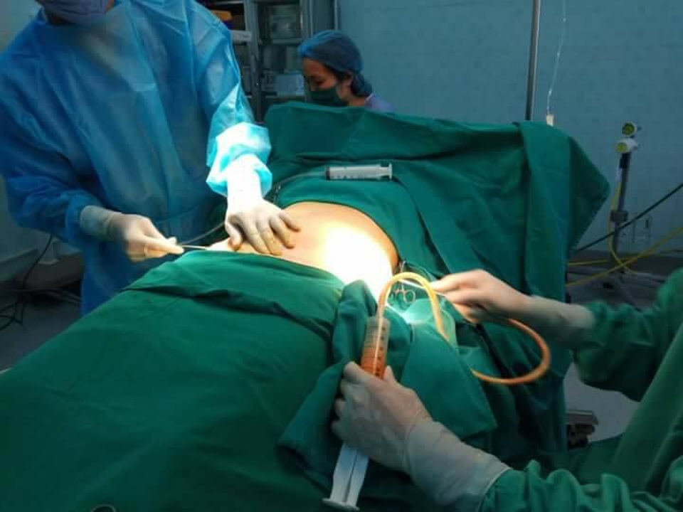 Thẩm mỹ viện “chui” ngang nhiên hoạt động - 2 Một ca hút mỡ bụng chui diễn ra tại Bệnh viện Nhi Thanh Hóa