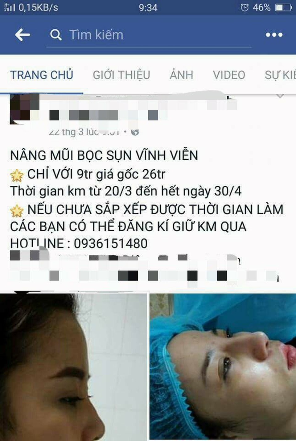 Thẩm mỹ viện “chui” ngang nhiên hoạt động - 1 Nhiều cơ sở TMV chui nhưng vẫn công khai quảng cáo trên mạng xã hội