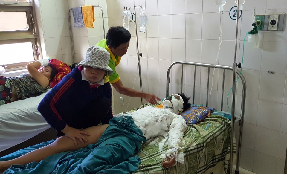 Học sinh bị phóng điện: Do leo cột điện để chứng minh tình yêu - 1
Em Đạt nhập viện với nhiều vết bỏng chiếm 42% diện tích trên cơ thể